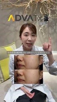 赤み・ニキビ・くすみ・色素沈着にお悩の方へ最新美容医療をご紹介