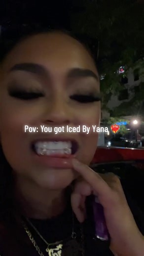 Stunning Women’s Grillz Trends You Need to See