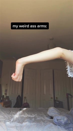 i would use the excuse that i’ve broken and dislocated it but my other arm is exactly the same #foryou #fyp #foryoupage