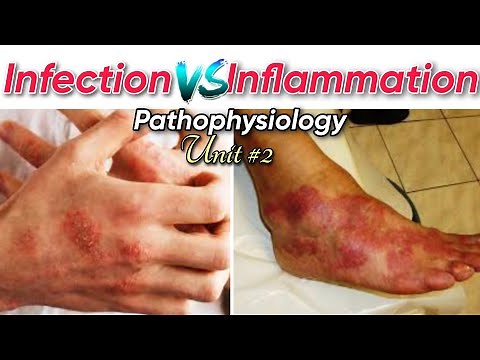 Infection Vs Inflammation | Pathophysiology chapter II | Explained by Tutor Hanif khan