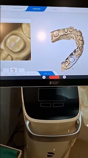 precise and fast work with intra oral scanner Dentsply sirona #youtubeshorts #digitaldentistry