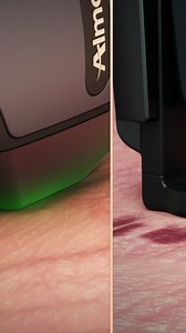 Alma Harmony: Powering Aesthetic Excellence with Diverse Technologies 🌟 Designed to address the most in-demand indications, Alma Harmony seamlessly integrates cutting-edge solutions to deliver precise, effective treatments for a wide range of skin concerns. 💡 A Look at Our Technologies: 🔹 IPL: Advanced applicators optimized for vascular conditions, pigmentation, acne, and hair removal. Tailored spectrums ensure safe light energy delivery for effective results. ​Q-Switch Laser (1064nm & 532nm)