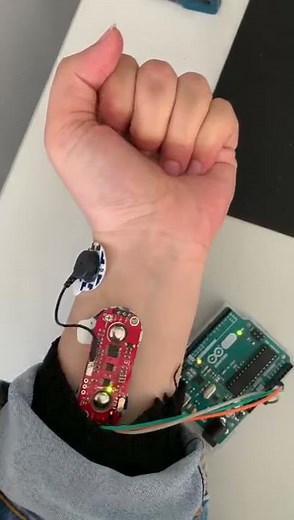 EMG signal on Matlab - UCLan