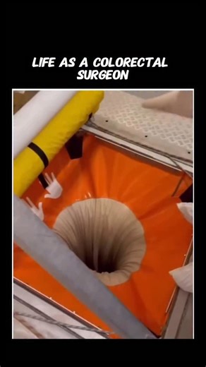 Nick Pappas, MD on Instagram: "All in a day’s work! Gotta wait for that propofol to go in before you start your procedure. #colorectalsurgeon #proctologist #career #funny #joke"