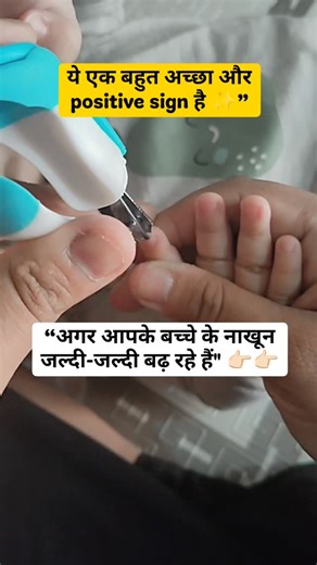 Mammu ki mamta on Instagram: "बच्चे के nails तेजी से बढ़ न कोई tenstion नहीं खुशी की बात है।बच्चे का development अच्छे से हो रहा है।उसको vitamins, nutrients अच्छे से मिल रहे है। इस लिए nails तेजी से grow करते है। #gujratimom #kidshealthttips #parentinggujrati #momlifegujrati #babycaretips Baby Health, Gujarati Pairenting, Healthy Baby Signs, Mom Tips, Fast Nail Growth, Child Development, New Mom Guide, Motherhood India"