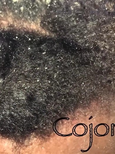 10K views · 110 reactions | Dandruff asmr scratching removal on head using combing | Entertainment | Facebook