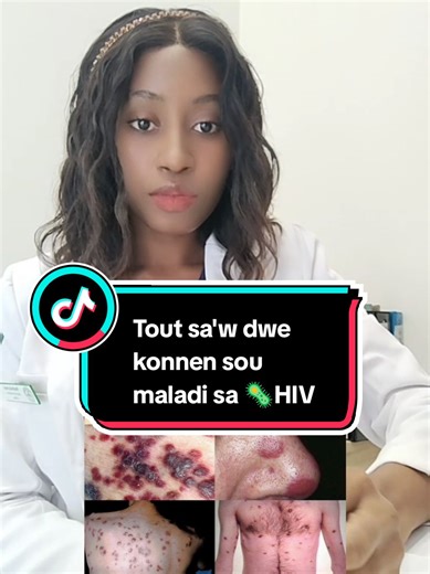 Tout sa'w dwe konnen sou enfeksyon VIH