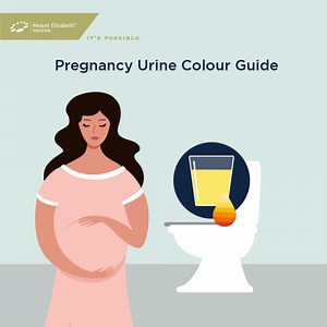 61 reactions · 5 comments | Did you notice a distinct change in the...