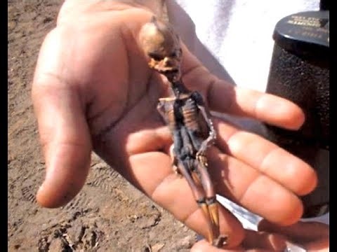 The Atacama “Alien”: Mystery Solved or Extraterrestrial Enigma?