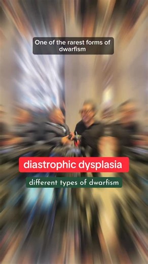 Aubrey Smalls | Do you know any of the types of dwarfism? Let’s learn about Diastrophic Dysplasia 👨🏾‍🏫 The most common types include Achondroplasia,... | Instagram