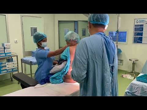 Combine Spinal Epidural (CSE) in short, so quick!