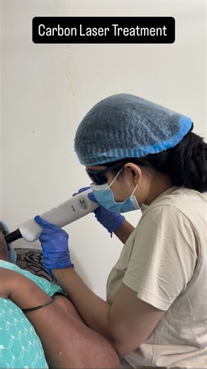 Dr Shivani Kakde on Instagram: "Carbon Laser Treatment is a game-changer for your skin! 😊 Here are the benefits: *Skin Rejuvenation* - _Deep Cleansing_: Removes dirt, oil, and dead skin cells, unclogging pores and reducing acne. - _Exfoliation_: Gently removes dead skin cells, revealing smoother skin. - _Brightening_: Evens out skin tone, reducing dullness and hyperpigmentation ¹ ² ³. *Anti-Aging* - _Collagen Boost_: Stimulates collagen production, reducing fine lines and wrinkles. - _Skin Firm