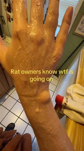 Rat owner's skin-colored rat shock