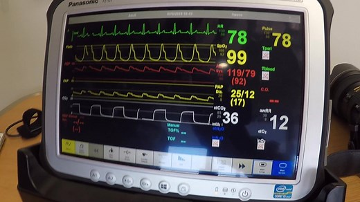 The Mike O'Callaghan Military Medical Center became the first Air Force Hospital to include a Tele-ICU Program. The program provides patients with a second set of caregivers in the form of VA nurses and doctors from around the country. U.S. Air Force Medical Service - AFMS | Nellis Air Force Base