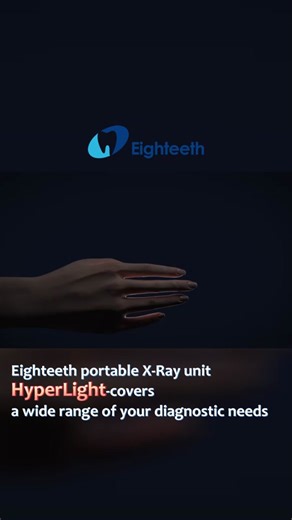 Portable X-Ray Equipment: HyperLight Diagnostic Device