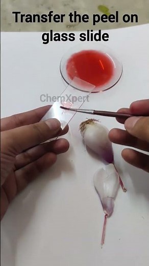 Activity 5.1| Onion peel |Temporary Mount of Onion peel| Class 9 Science