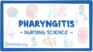 Pharyngitis: Nursing: Video & Causes | Osmosis