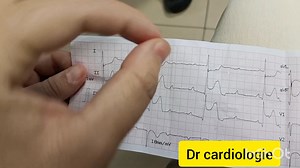 ECG ❤️‍🩹 | Cardio logie
