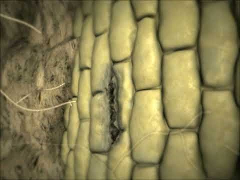 Root Rot (Rhizoctonia solani) Preview Clip