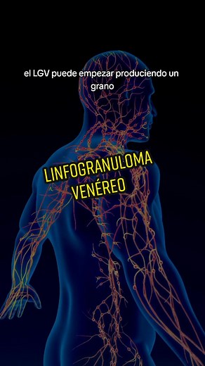¿Qué es el Linfogranuloma Venéreo (LGV)?