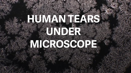 The microscopic beauty of our tears.