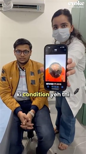 Advanced GFC Treatment for Hair Loss | Doctor-Recommended Before Hair Transplant | Patient Result