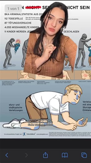 Lebenswach on Instagram: "Dieses Bild stammt nicht von mir, sondern von einer ganz wichtigen Seite, die ich euch unten in der Beschreibung verlinkt habe. Das Profil habe ich natürlich auch markiert. 💛 Ich habe dieses Video schon einmal vor etwa einem Jahr geteilt – aber das Thema Kinderschutz bleibt aktuell. Es ist mir wichtig, immer wieder darauf aufmerksam zu machen. Diese Grafik zeigt auf eindrückliche Weise, wo man bei Kindern genauer hinschauen sollte. Natürlich können blaue Flecken auch a