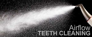 Air Flow Teeth Cleaning | Airflow Dental Treatment | Airflow