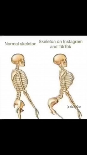 Dirty Memes on Instagram: "Why does it look like the normal skeleton is slapping the Tik tok skeleton cheeks 👀"