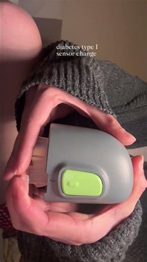 type 1 diabetes - sensor change