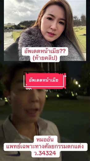 อัพเดตดึvหน้าชุดใหญ่ #หมออ้นฉัตรพล #หมออ้น #idlhospital #ดึงหน้าหมออ้นidl #ดึงคอหมออ้นidl
