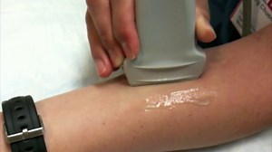 Probe Manipulation - Rotation