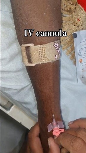 IV Cannula Removal Step-by-Step | Safe Technique for Nurses & Healthcare Students (USA)