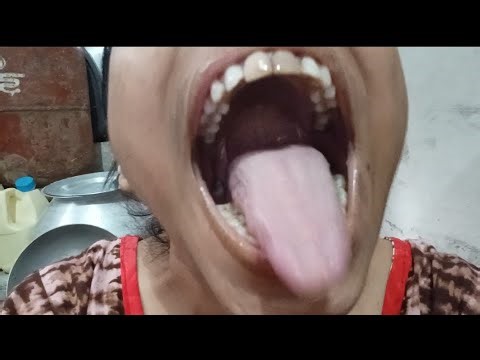 Open Mouth With Big Toung Challenge Video👄👅Most Requested Video 📷