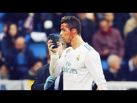 The 4 worst injuries of Cristiano Ronaldo's career | Oh My Goal