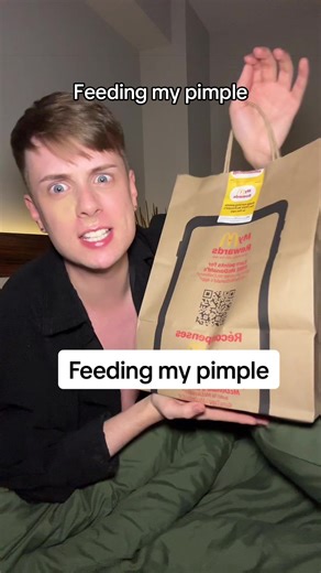 Me and my giant pimple got HUNGRY after giving it a good pop, so I treated us to some McDonald’s! 🤭 my body loves junk food so hopefully this will help with the healing process 👀