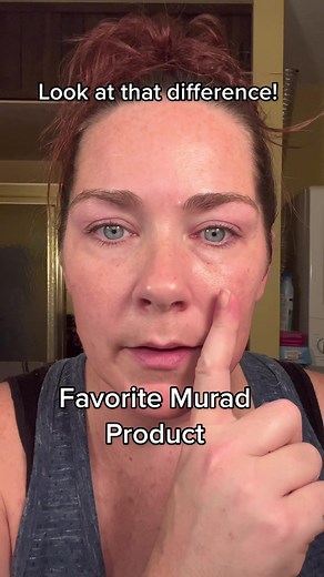 Murad Targeted Wrinkle Corrector Review