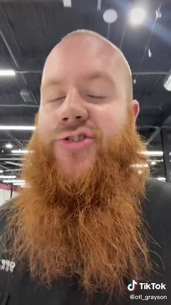 Understanding Subaru STi Center Differential Mechanics