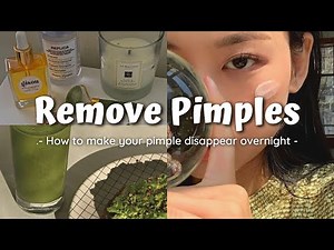 How to make your pimples disappear ✨ OVERNIGHT ✨