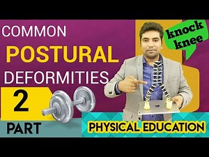 Common Postural Deformities| Physical Education | unit-5| PART-2|