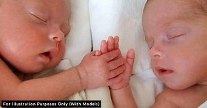 A Year After Being Separated, Conjoined Twins Celebrate Their New Lives