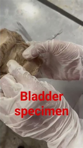 Human bladder model🛌 #anatomy #hospitaldoctor ♥️#doctor #emotionalmedico #hospitalemployee #biology