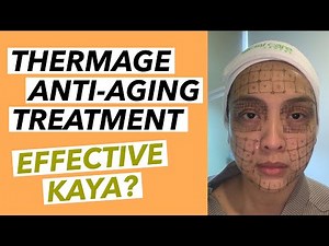 THERMAGE ANTI-AGING TREATMENT- Is it effective? #thermage #cherylcosim