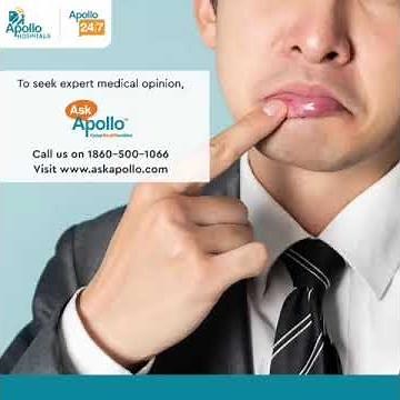 How to deal with Mouth Sores - Causes, Types, Symptoms, Treatment & Prevention Methods