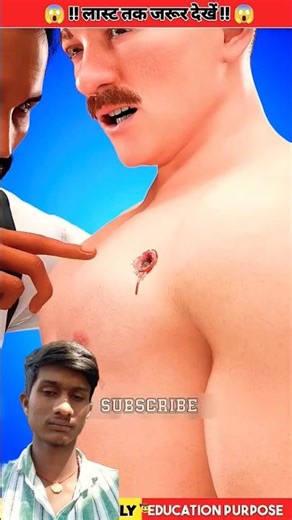 How Doctors Used to Remove Bullets in the Old Days!