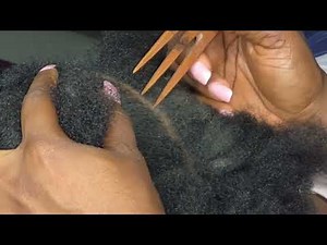 ASMR Intense scalp scratching after braids~dirty/dry 4c hair 😴 💤