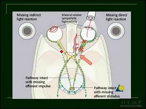 neuro ophthalmology pt 2