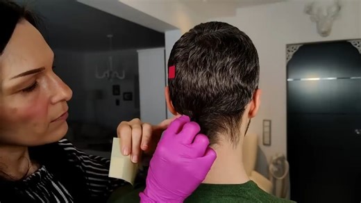 【ASMR 助眠-Female组合】头皮分析- Dandruff & Scalp Analysis