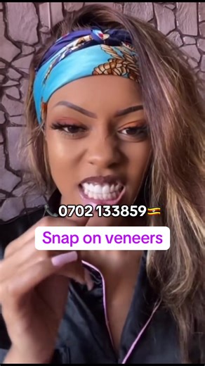 Transform Your Smile with Snap-On Veneers Today