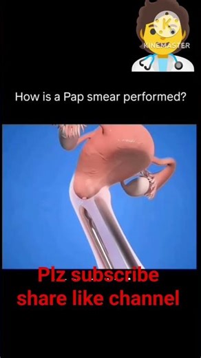 pap smear 3d animation #shortsfeed #youtubeshorts #shorts